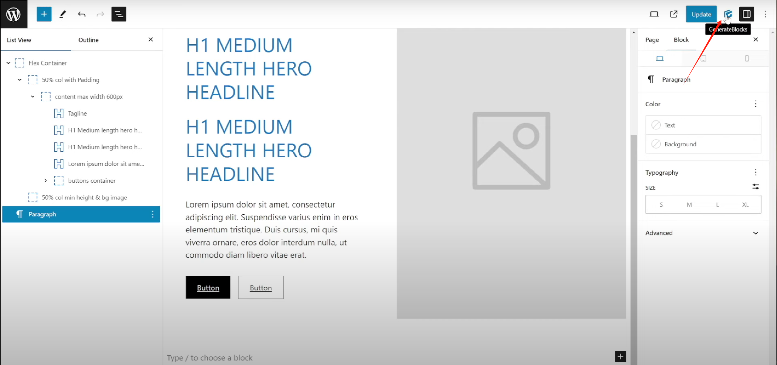 Image [9]-Les caractéristiques de la bibliothèque de styles et de modèles globaux GenerateBlocks en détail : créer rapidement une structure de page efficace